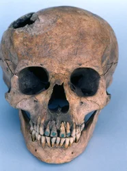Skull with jade-encrusted teeth